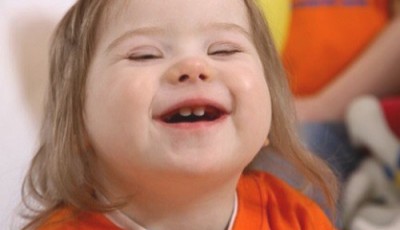 Imagen de una niña con síndrome de Down